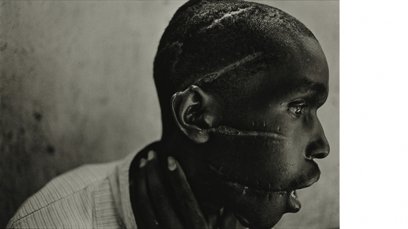 Gitarama, Rwanda, 1994. A man who had been held prisoner in a Hutu concentration camp had just been liberated by the advancing Tutsi guerrilla army. His face bore the scars of extreme mistreatment. 